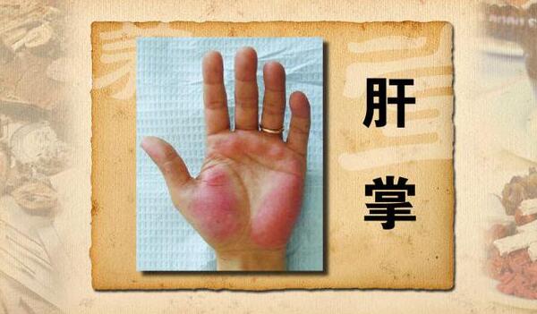 右手断掌的男人一生命运 头脑聪慧生财容易