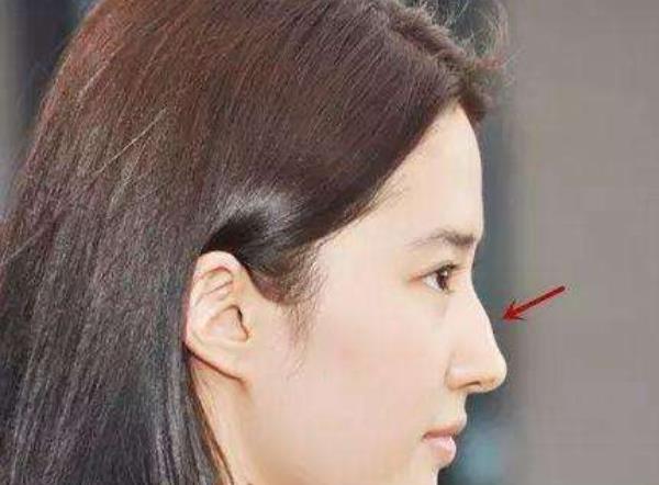 女人有金星线好吗 旺财旺夫手相