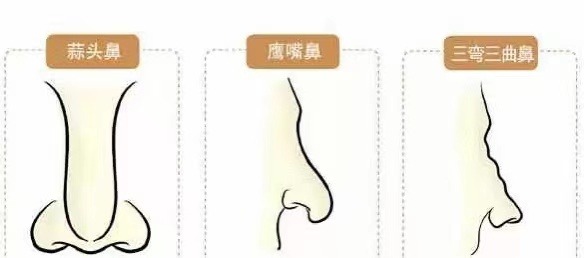 婚姻星两颗会不会二婚 桃花星在婚姻宫上象征意义