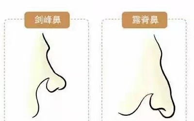 扫把眉的男人可以嫁吗 扫把眉的男人图片