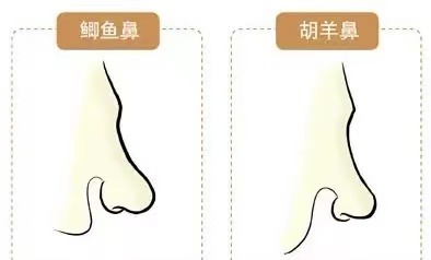 5条婚姻线一定就不好么 婚姻线多条代表情欲旺盛