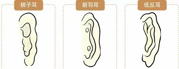 断手掌的女人克丈夫吗 双手断掌福薄命薄