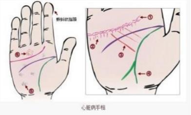 贵人纹手相男士 健康平安事业发展昌盛