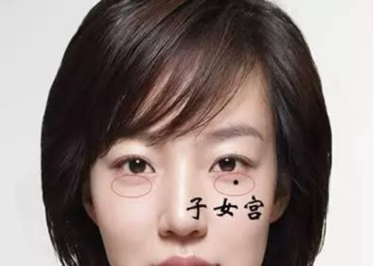 痣与人的命运息息相关 分清好痣和恶痣