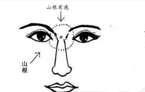 肩膀上三颗痣连成一条线 一生必定神秘莫测