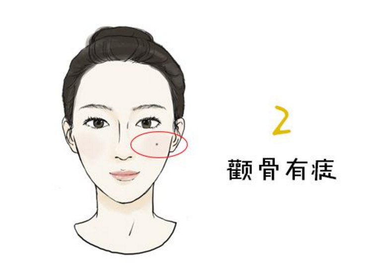 颧骨有痣是好的吗 女性长有可能会克夫