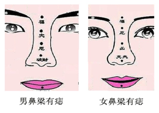 男人额头有观音痣黑色的好吗 福气与贵气并临